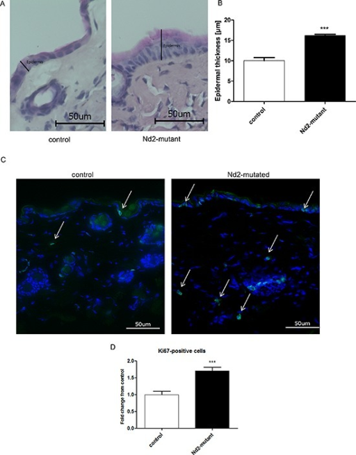 measurement of epidermal thickness and ki67 staining of open i ki67 staining