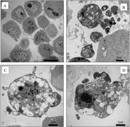 Representative TEM images of HEp-2 cells treated with P | Open-i