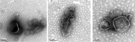 NS-TEM images of liposomes. | Open-i