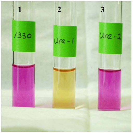 Urease test broth 24 hours after inoculation with B. su | Open-i