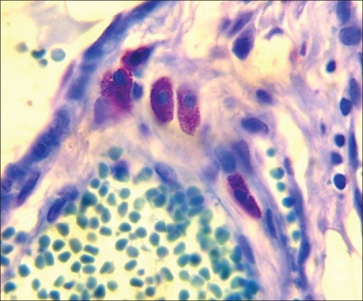 Photomicrograph of toluidine blue stain showing mast ce | Open-i