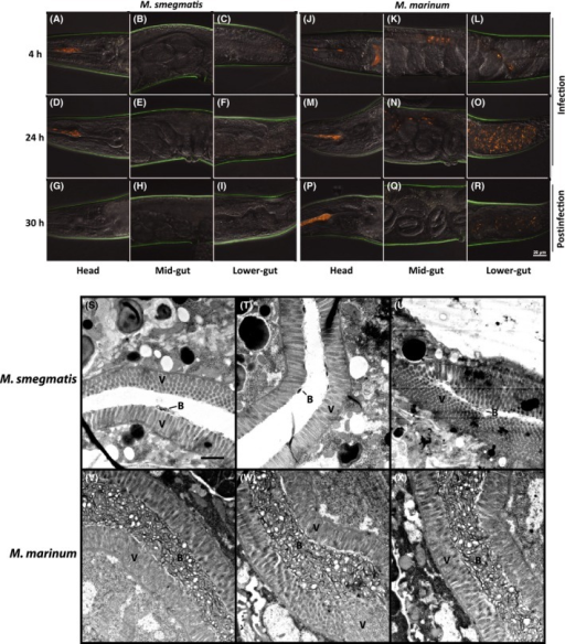 Confocal And Transmission Electron Microscopy Of Infect Open I