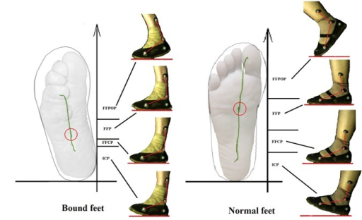 the-center-of-pressure-cop-trajectory-of-bound-feet-open-i