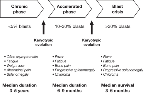 Chronic myeloid leukemia: triphasic clinical course | Open-i