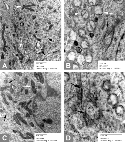 Electron microscopy reveals phloretin and pimaric acid | Open-i