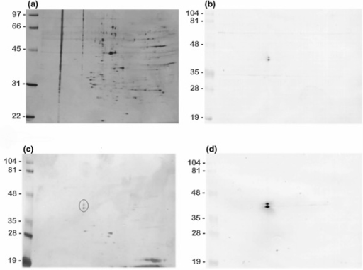 2d gel electrophoresis