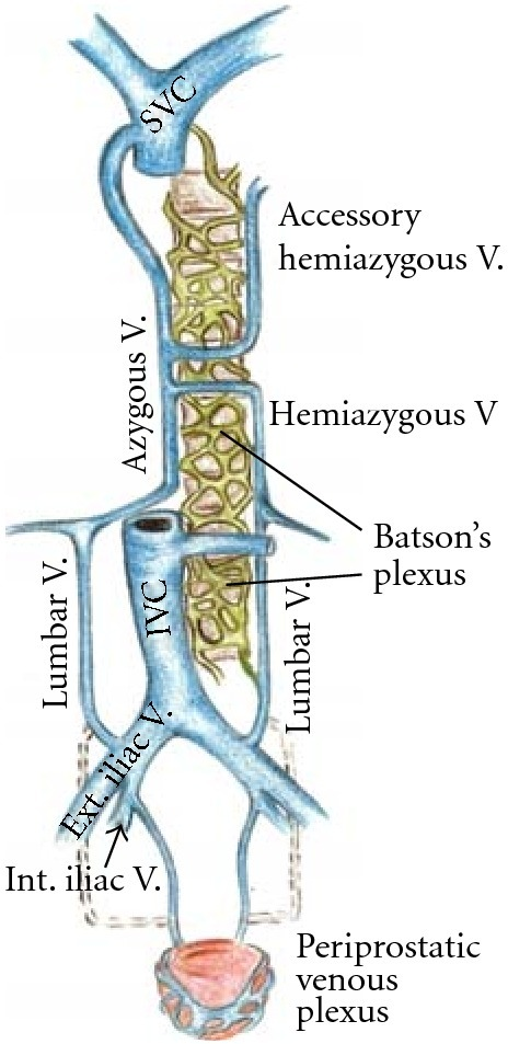 The Periprostatic Or Paravaginal Plexus Drains Primaril Open I