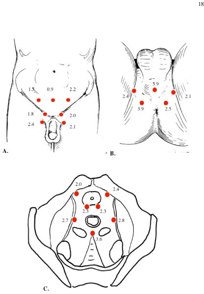 Pelvic Floor Trigger Points Diagram Female