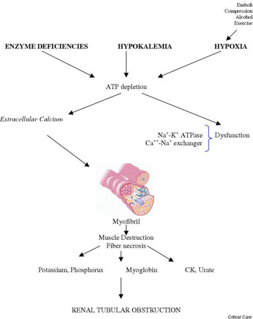 Rhabdomyolysis Pathophysiology