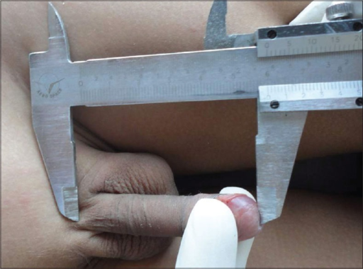 Measurement Of Penis 57