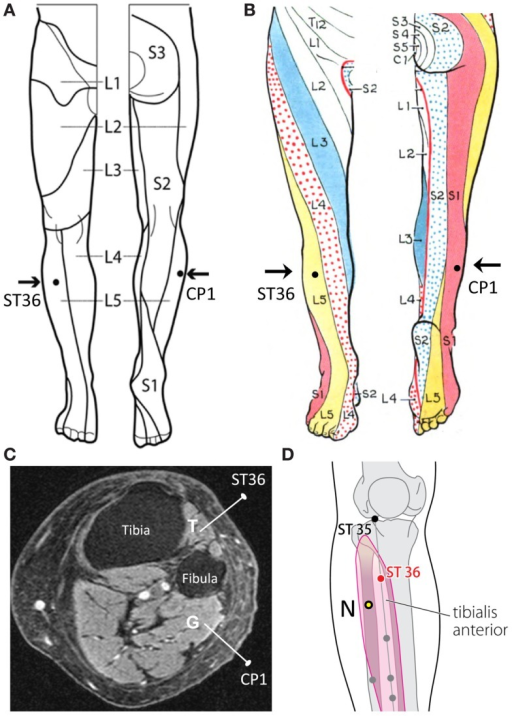 (A) ST36 and CP1 placements located within the dermatom | Open-i