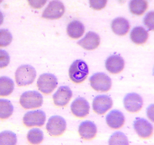 Babesia vogeli. Two Babesia sp. trophozoites in a blood | Open-i