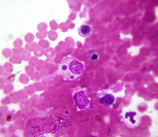 Ehrlichia canis. A morula of Ehrlichia canis in a bone | Open-i