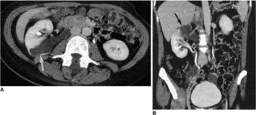 ct urography atlas