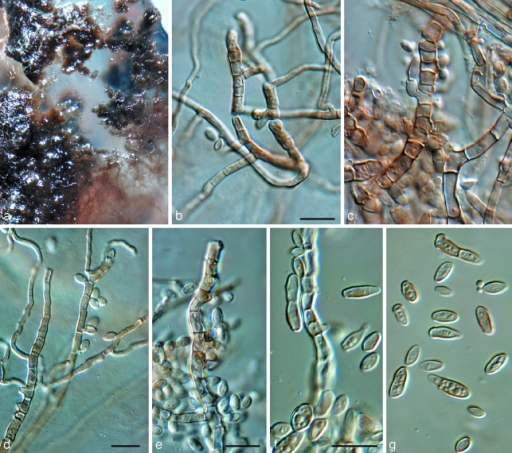 Teratosphaeria hortaea (CPC 15716). a. Colonies on SNA; | Open-i