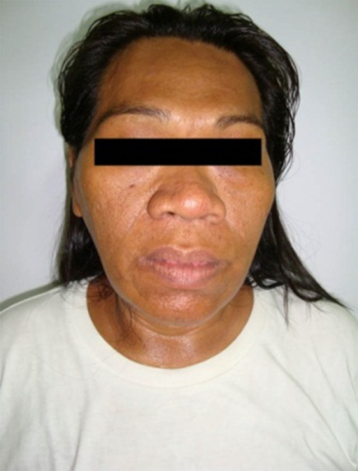 Coarsening of the facial features images 292