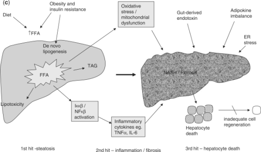 (a) The traditional 2-hit hypothesis: steatosis represe | Open-i