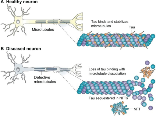 (A) Tau Facilitates Microtubule Stabilization Within Ce | Open-i