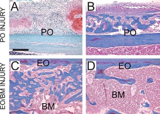 Periosteal injuries heal by endochondral ossification, | Open-i