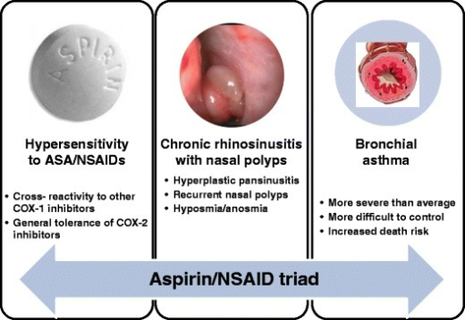 Nasal polyps store asthma