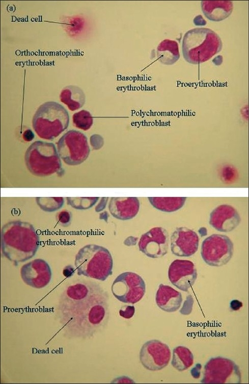 Images of cytospin slides on day 12, of cells derived f | Open-i