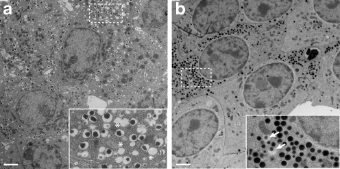 Appearance of ISGs in chemically and HPF fixed beta cel | Open-i