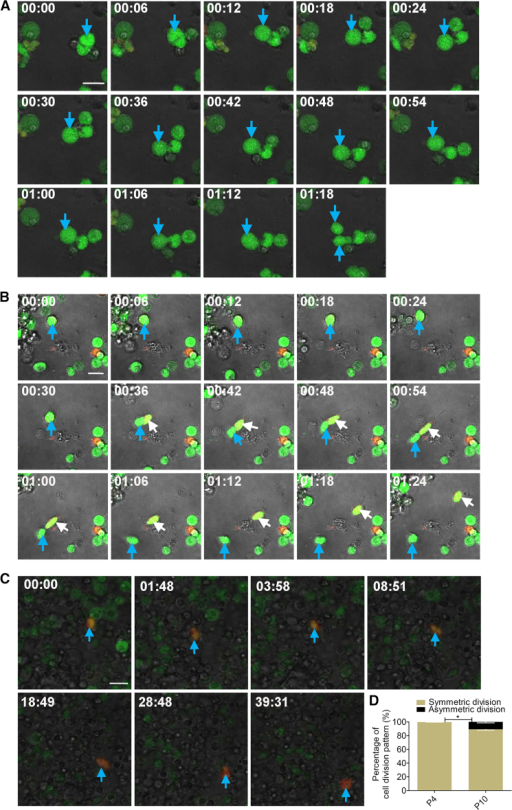 Cerebellar Granule Progenitors Undergo Both Symmetric a | Open-i