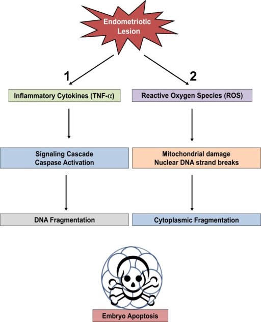 Endometriosis: MedlinePlus Medical Encyclopedia