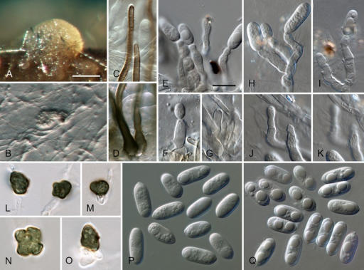 Colletotrichum Colombiense From Ex Holotype Strain Cbs Open I