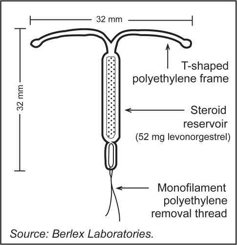 Levonorgestrel Releasing Intrauterine System Lng Ius Open I