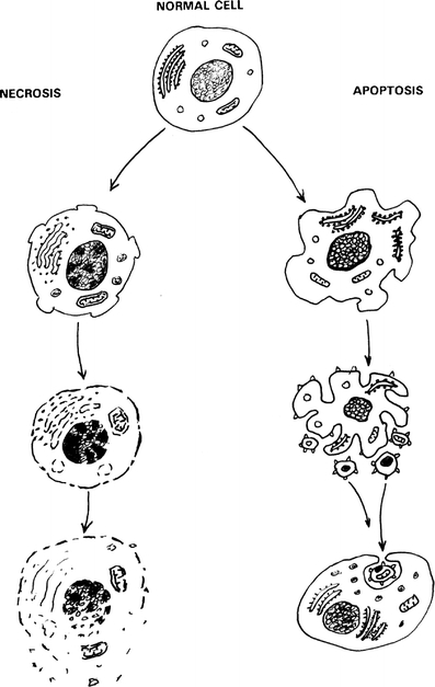 Schematic representation of the different stages of nec | Open-i