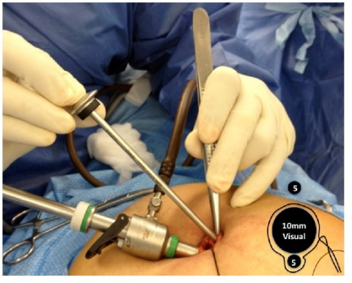 Comparison of three purse-string suture techniques for prevention of anal  leakage during surgery in: American Journal of Veterinary Research Volume  83 Issue 3 (2022)