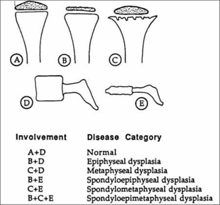 Radiographic Abnormalities Helpful In Classification Of | Open-i