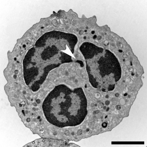 Neutrophil Morphology Transmission Electron Microscopy Open I 2607