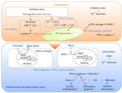 Malignant transformation of endometriosis: a fine-tuned | Open-i