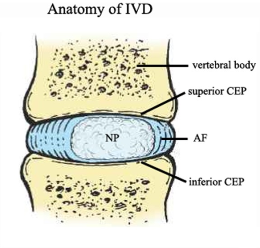 The structure of anatomy of the IVD.The IVD is composed | Open-i