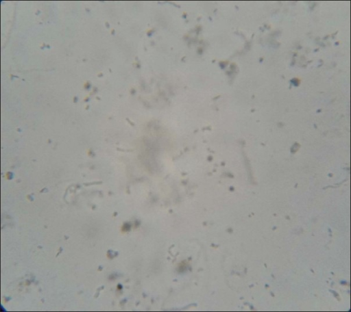 KOH wet mount showing fungal hyphae and spores (×40) | Open-i