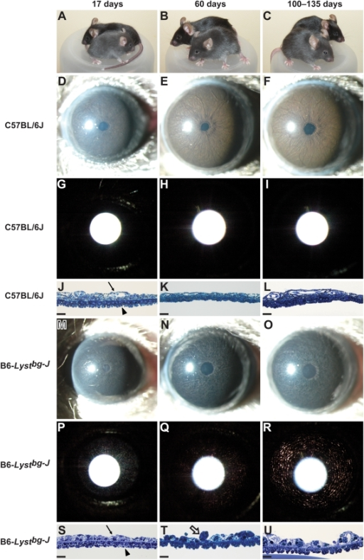 B6-Lystbg-J mice exhibit degenerative iris phenotypes.C | Open-i