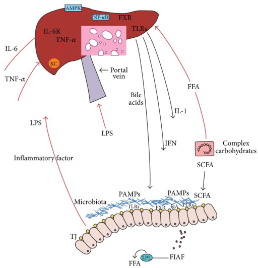 Gut-liver axis in NAFLD. | Open-i