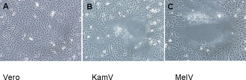 Cytopathic effect observed in Vero cells infected with | Open-i