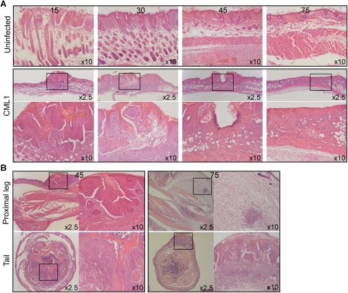 Histology of back skin (scarified-zone), proximal leg a | Open-i