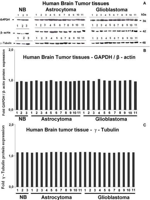 Invivo protein expression of human housekeeping genes Openi