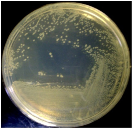 Colonies Development Of E Coli Dh5α After 24 H Incuba Open I 2026