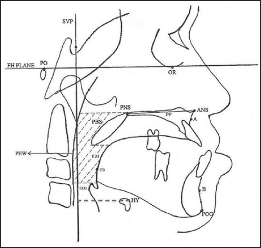 Cephalometric Landmarks-Orbitale (OR): The lowest point | Open-i