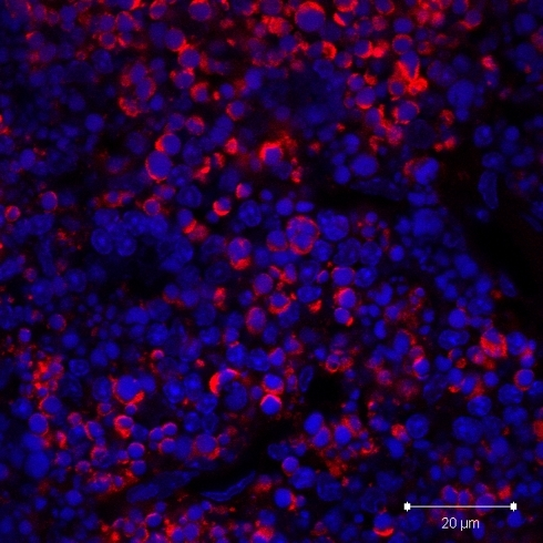 Paraffin section of thymus from mouse treated with dexa | Open-i