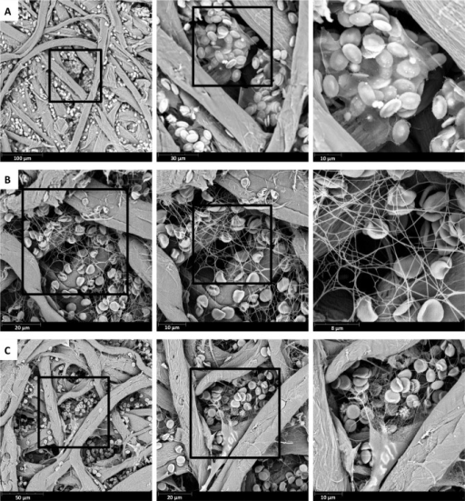 This scanning electron micrograph (SEM) depicted a number of red