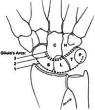 Diagrammatic representation of the 3 carpal arcs of Gil | Open-i