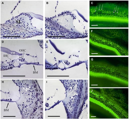 Comparative Study Of Cochlear Morphology After Noise In Open I