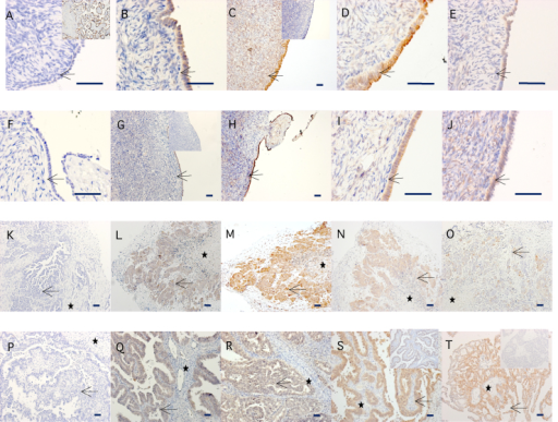 Immunolocalization Of Aromatase A F K P Sts B G Open I