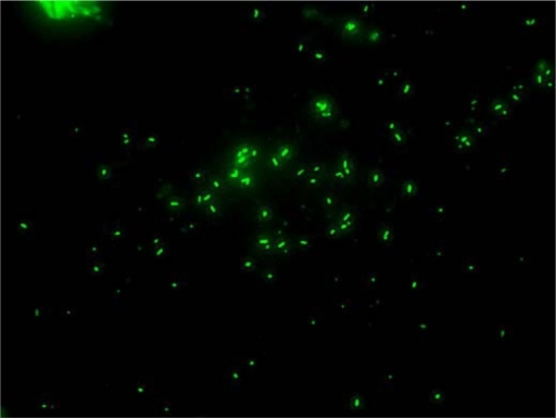 M. marinum – auramine stain. | Open-i